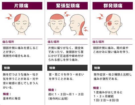 常頭痛|頭痛の種類まとめ～それぞれの違いと原因、症状、治。